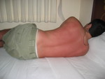 Grasso sunburned - didn't see that one coming